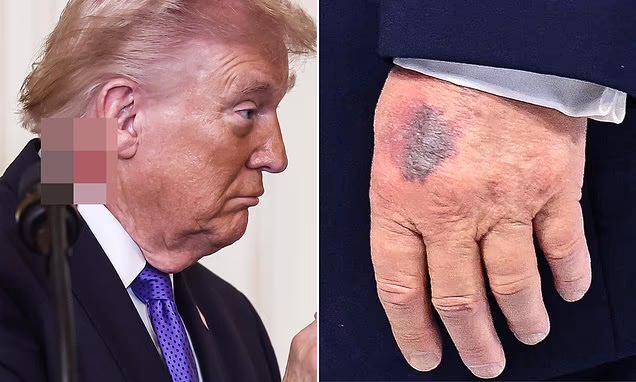 President Trump’s Daughter Ivanka Finally Speaks Out After He Was Rushed to the Hospital for the Third Time in 13 Months, as Ex-White House Doctors Sound Danger Alarm: “My Dad Is…” See More