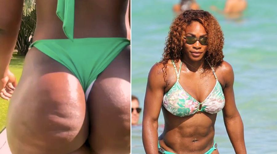 Serena Williams New Mouth Watering Close-Up Look of Her Giant Backside Private Photo, Fans Are All Saying the Same Thing After Big Bouncing of Her Giant Backside Shut Down the Internet and Made Fans Go Crazy After It Slipped
