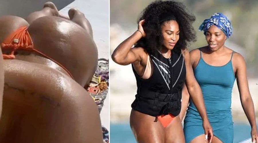 Serena Williams Irresistible giant backside on yatch photo send fans crazy, but what caused more damage was the moment the yatch hit turbulence and jiggle the giant backside losing the rope of the bikini and reveals a...