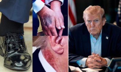 BREAKING: I’m no big city doctor but I don’t think it’s supposed to look like that. President Trump has just been Confirmed... See more