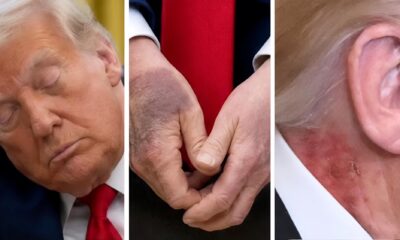 BOMBSHELL REVEAL: Trump's Secret Illness Accidentally Leaked with Classified UFO Files – White House in Chaos