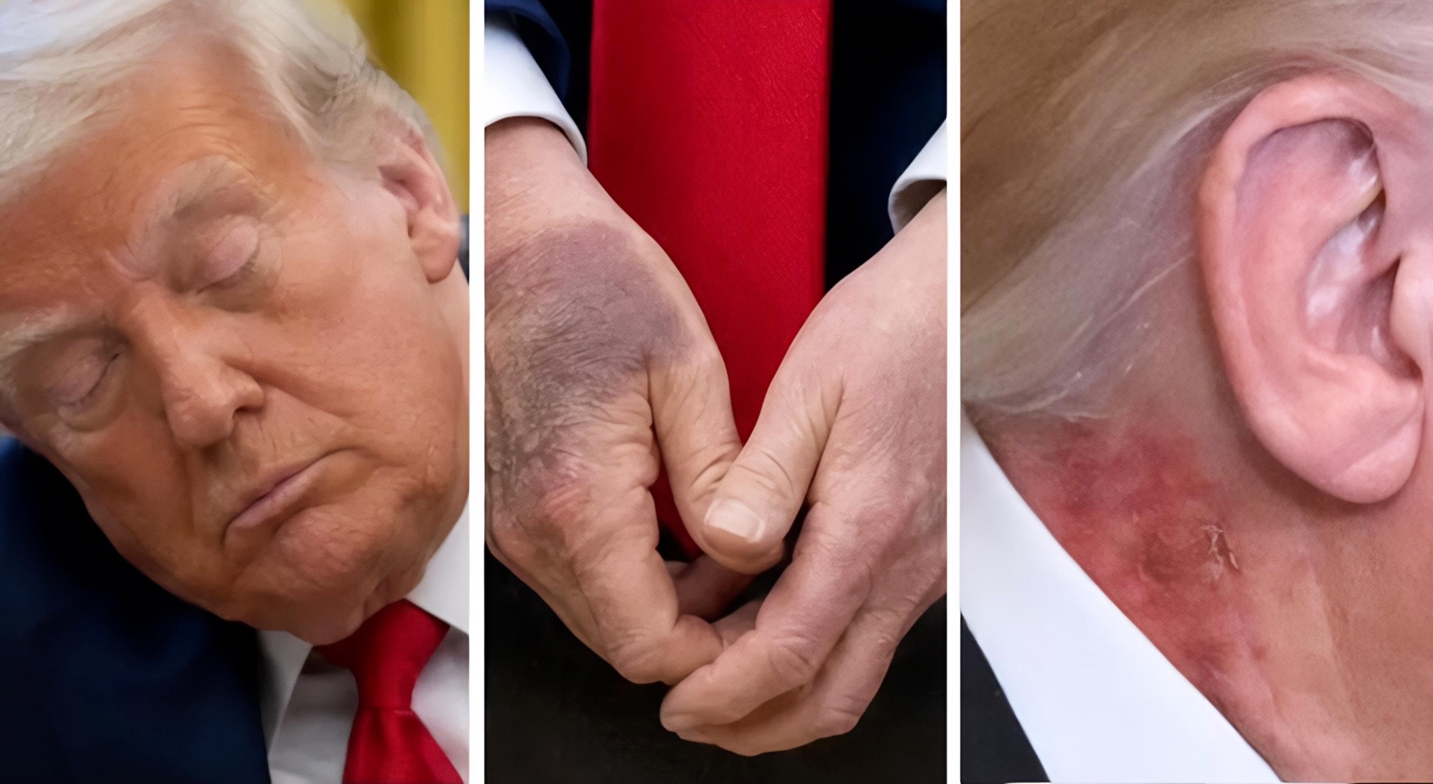 BOMBSHELL REVEAL: Trump's Secret Illness Accidentally Leaked with Classified UFO Files – White House in Chaos