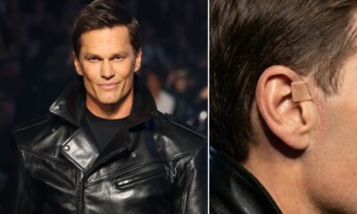 TRENDING: Photos are circulating of an unusual tab seen on Tom Brady’s face from the Gucci fashion show in New York.