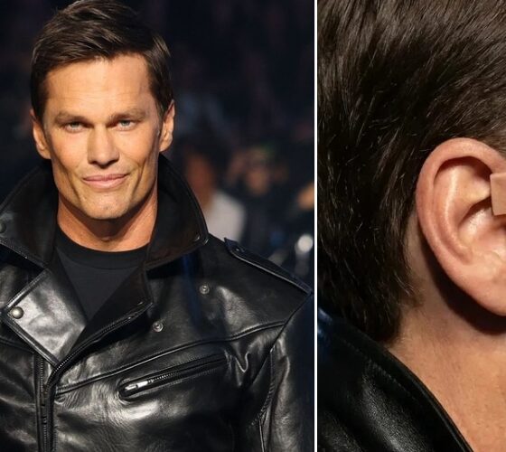 TRENDING: Photos are circulating of an unusual tab seen on Tom Brady’s face from the Gucci fashion show in New York.