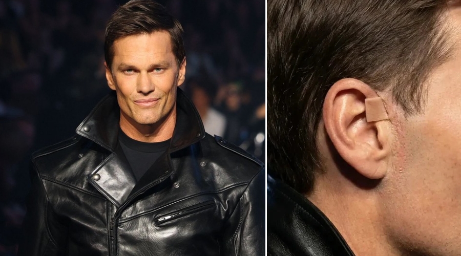 TRENDING: Photos are circulating of an unusual tab seen on Tom Brady’s face from the Gucci fashion show in New York.